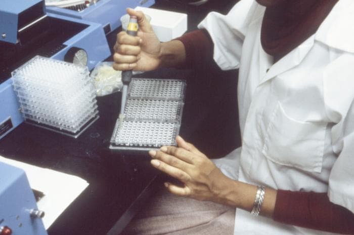 Réactifs d'immuno-sérologie en stock chez Angela Diagnostics et Services à Yaoundé