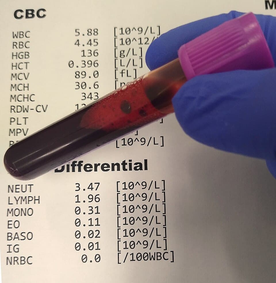 Cryotubes (2ml)
